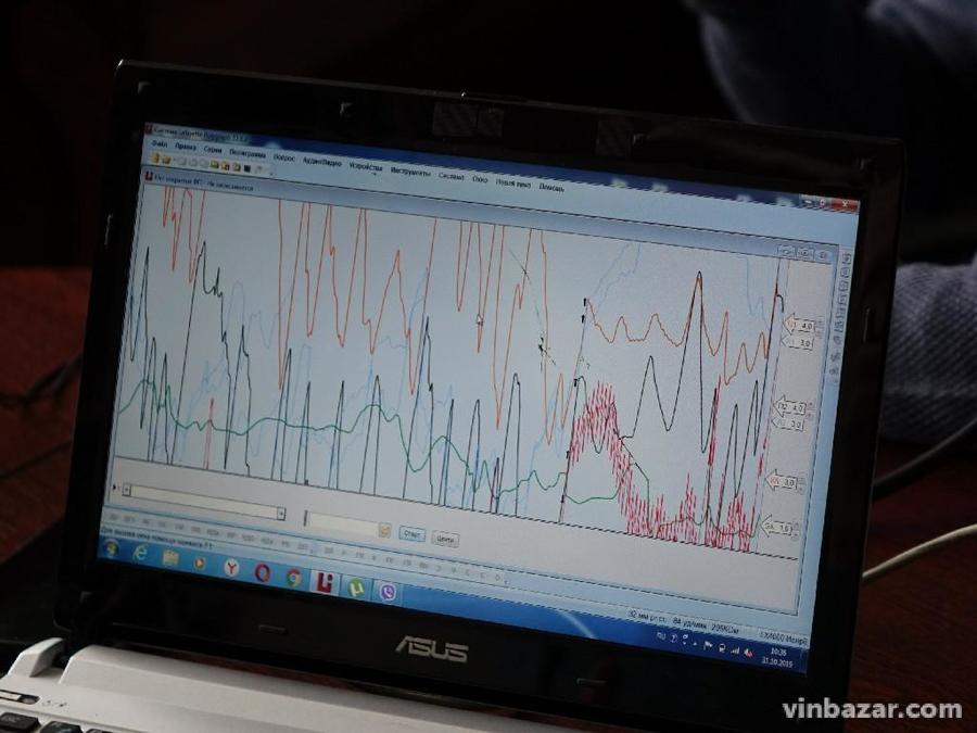 Детектор брехні у Вінниці: як у Вінниці працює поліграф-тест